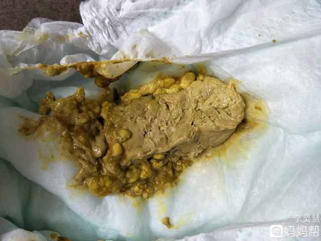 2岁宝宝腹泻能喝奶粉吗