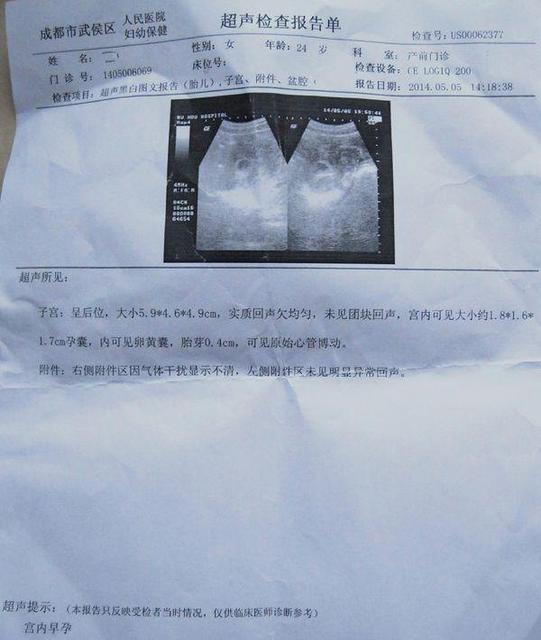 正常妊娠超声检查的时间是什么时候