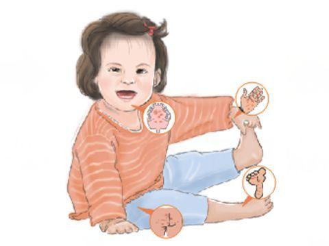 小孩子手足口病是什么症状