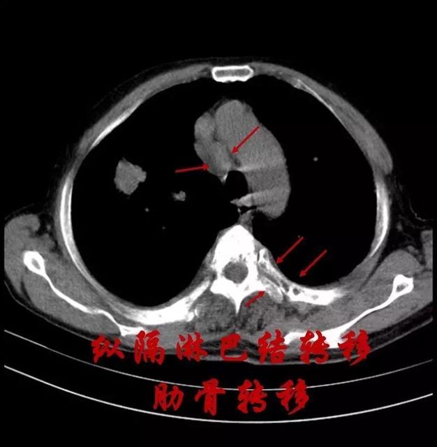 宝宝淋巴结变大怎么办
