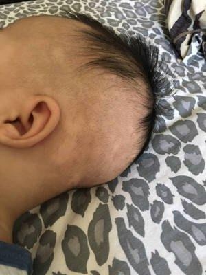 宝宝四个月大便几次正常