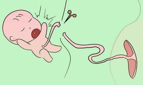 新生儿脐带脱落了多久可以碰水