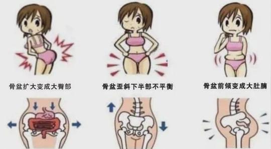 产后骨盆修复为什么很重要？看完这篇你就知道了！