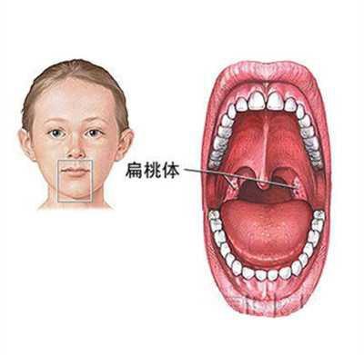 小孩喉咙正常的图片图片