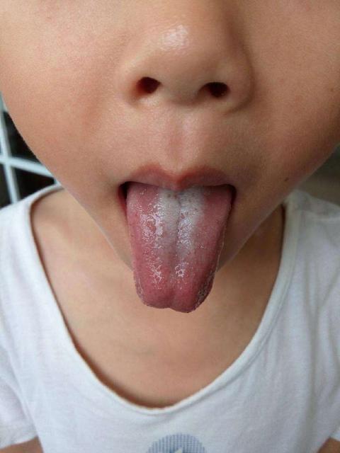 宝宝腹泻怎么办