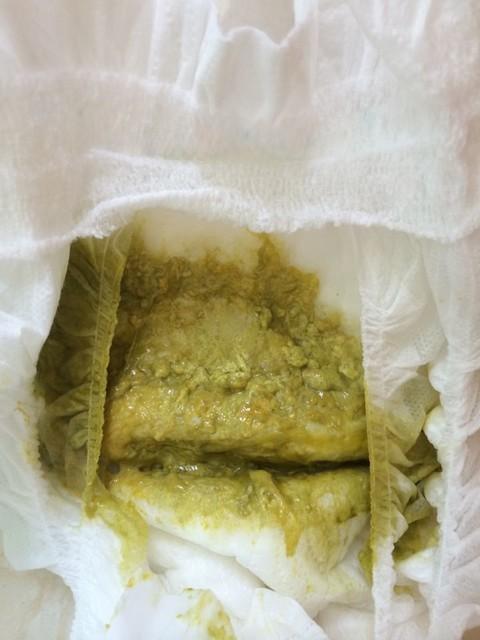 宝宝腹泻怎么办?