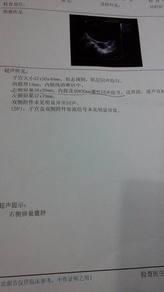 第一胎可以做人流吗