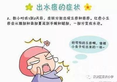如何预防水痘小知识