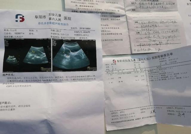 怀孕六个月胎儿图片
