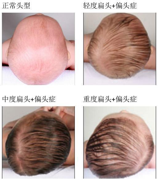 宝宝各种睡姿对头型的影响