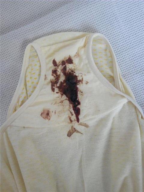 怀孕后肚子会变黑怎么回事