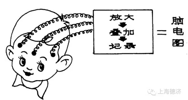 孩子得了儿童失神癫痫怎么办