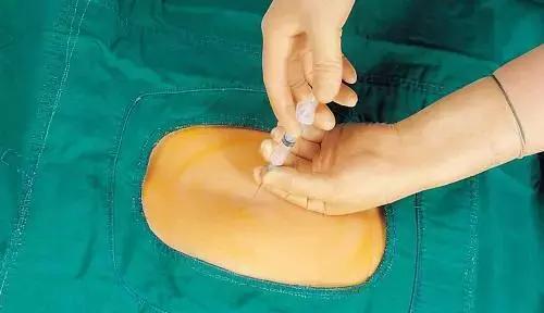 分娩前有哪些征兆