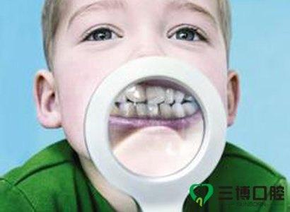 刚出生的宝宝要清洁口腔吗