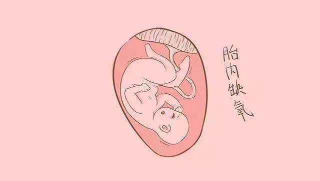 胎儿宫内缺氧的表现有哪些