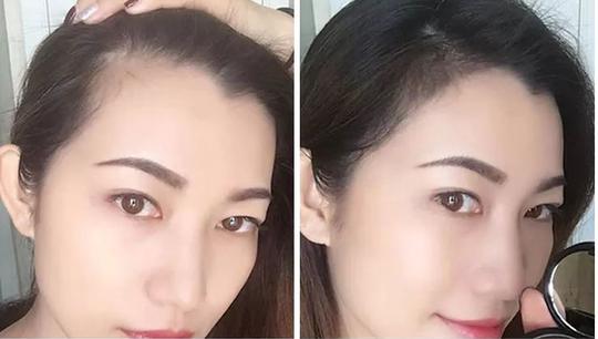 【拯救大额头抖音同款】发际线修饰粉修饰填充额头发际线摆脱脱发