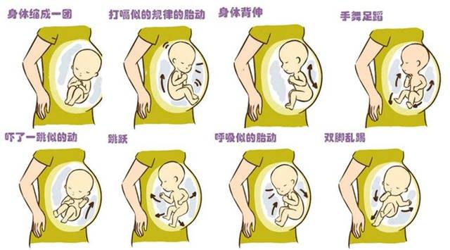 怀孕八个月胎动异常的症状