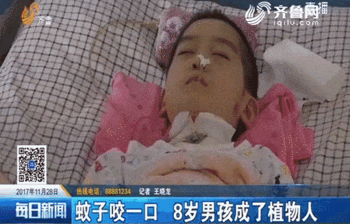 流行性乙型脑炎的症状有哪些
