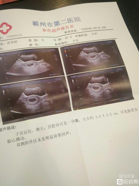 孕7周未见胎心胎芽正常吗