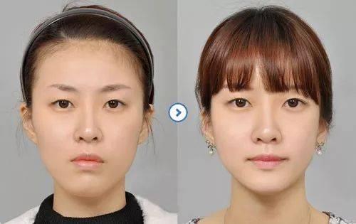 孩子几岁的时候可以开始做牙齿矫正