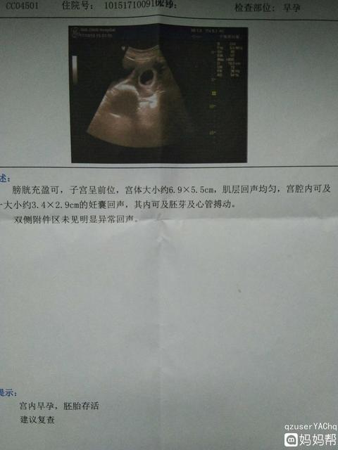 前三个月生男生女征兆有哪些