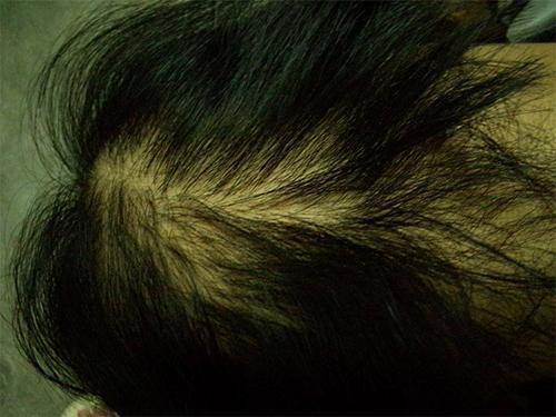 产后新妈妈的保健指导