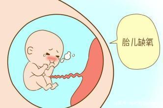胎儿缺氧概率高吗