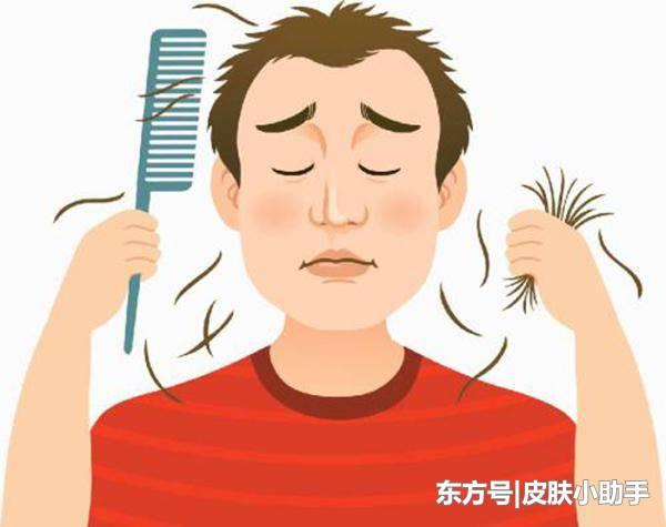 如何看待年轻人秃头已成常态