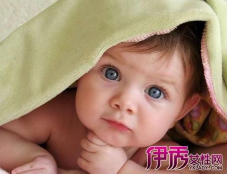 新生儿黄疸用药有哪些