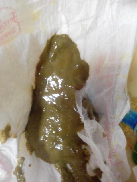 什么是吃母乳的宝宝的正常大便