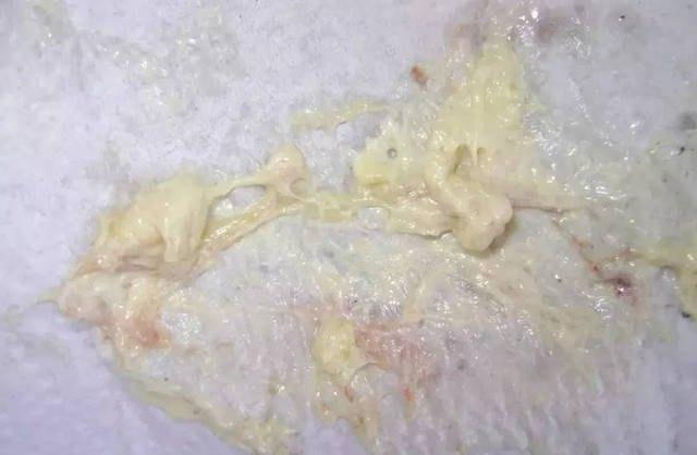 怎么从便便看出宝宝的身体