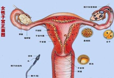 怀孕了发现子宫畸形怎么办