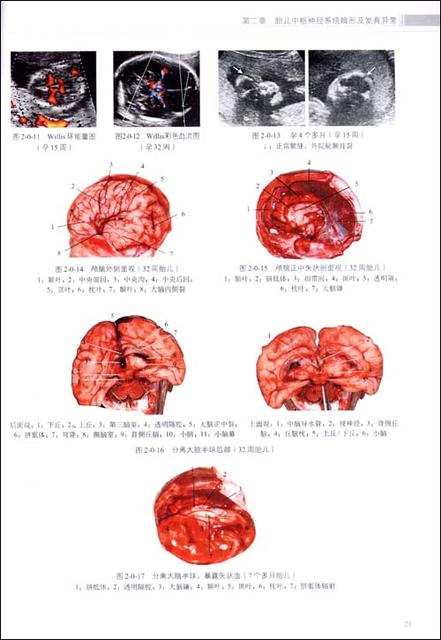 怀孕时胎盘前置是什么原因