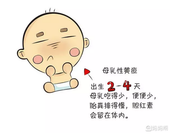 母乳性黄疸怎么回事?