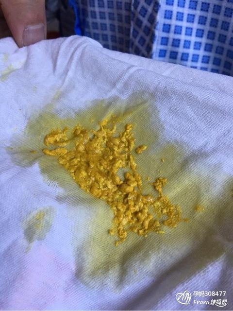 宝宝老放屁是消化不良吗