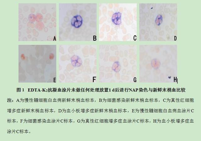 孕妇碱性磷酸酶偏低是什么意思