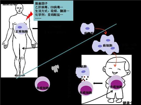 创业燕女郎能诱导癌症产生的因素,称为致癌因子,包括精神因素,遗传