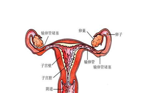 输卵管堵塞症状有哪些