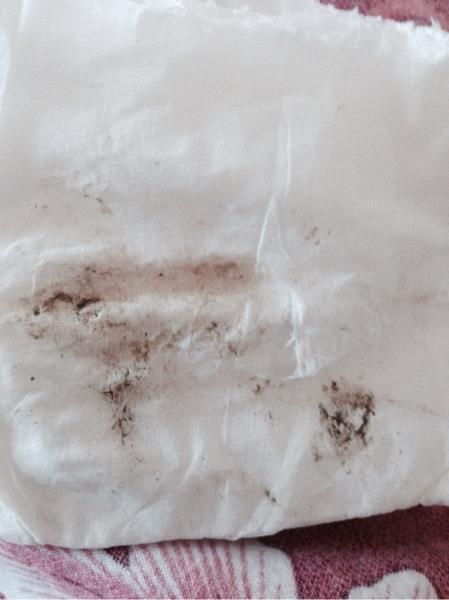 先兆流产要怎么办?