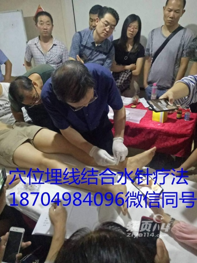 产后可以穴位埋线减肥吗