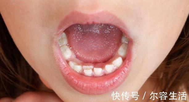 宝宝乳牙松动怎么处理