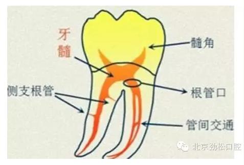 并非只是单纯性的牙髓炎和根尖周炎,也包括各种牙齿疾患病变,加深