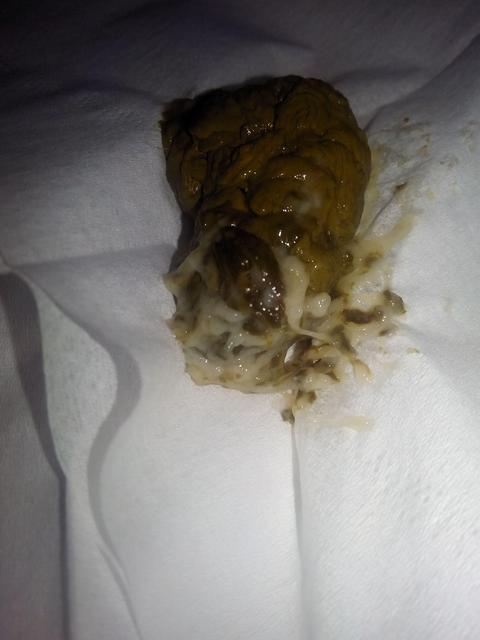 大便小便拉不出来是什么原因