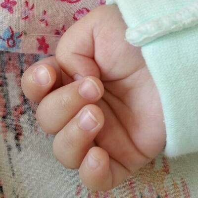 三个月宝宝拇指内扣正常吗