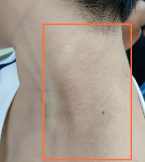 为什么给宝宝挠背就很容易入睡