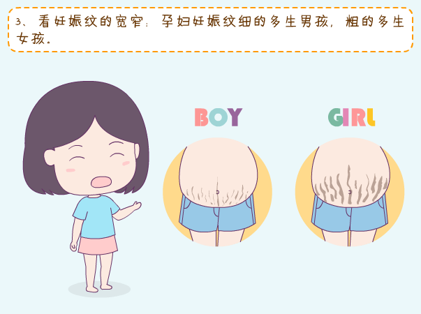 妊娠纹怎么看生男生女