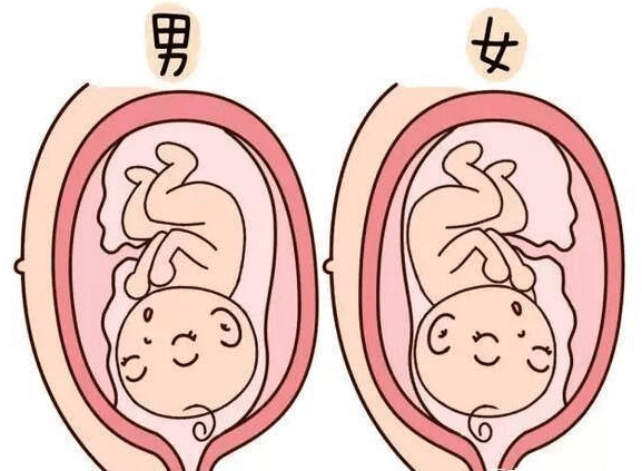 胎盘前壁怀孕注意事项
