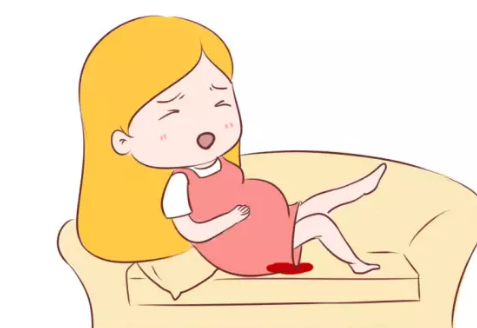 孕妇出血后多久会流产
