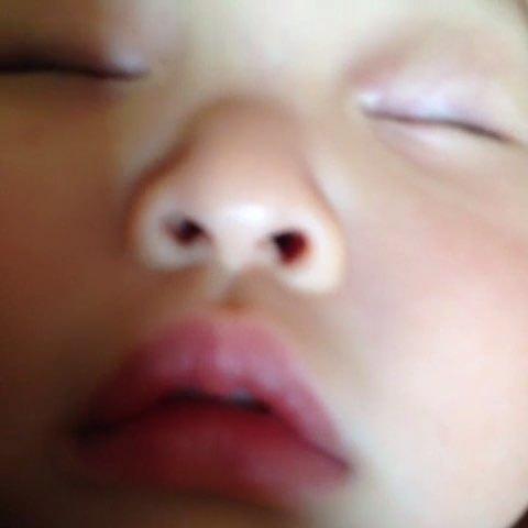 孩子鼻子不通气怎么办好点