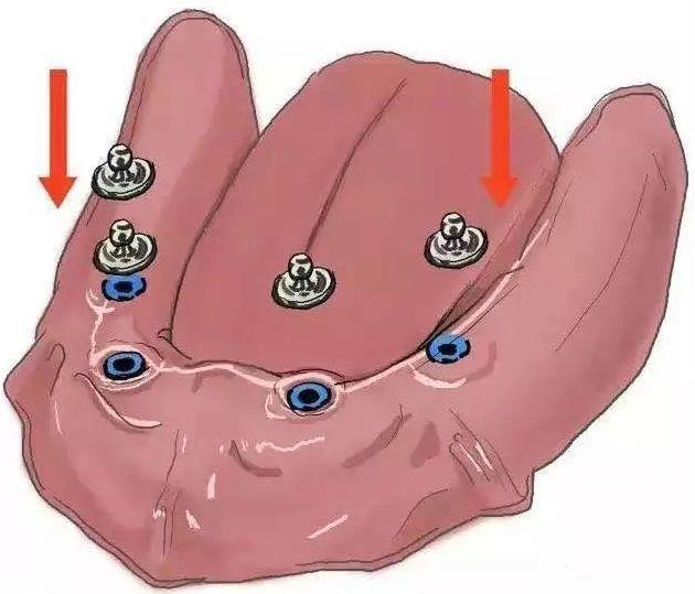宝宝口腔清洁有必要吗